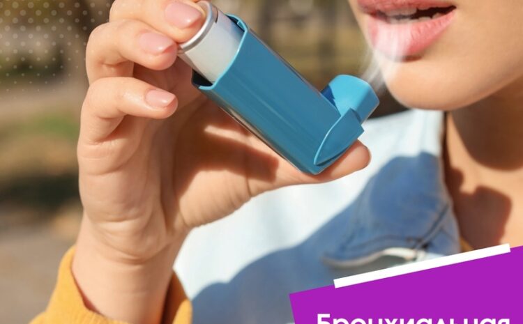  Бронхиальная астма